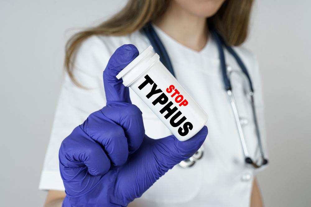 Featured image for Typhus: Symptoms, Treatment, and Prevention Strategies