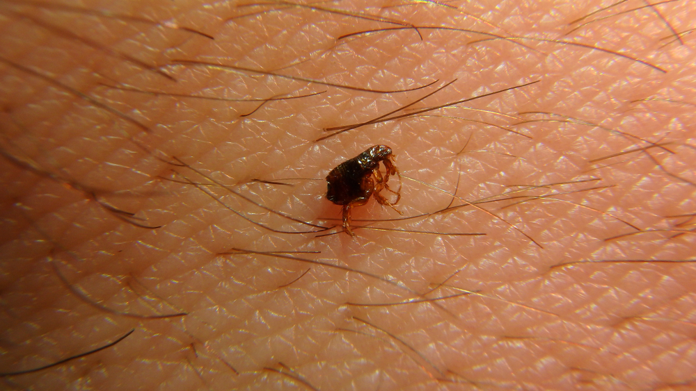 Featured image for How to Get Rid of Fleas on Humans: Effective Solutions and Tips
